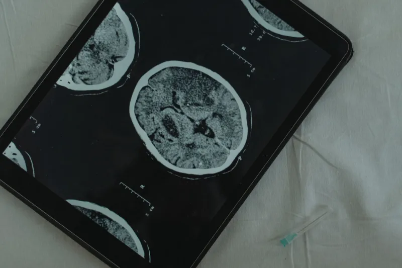 Your Brain on Mars: The Memory Crisis No One Is Talking About